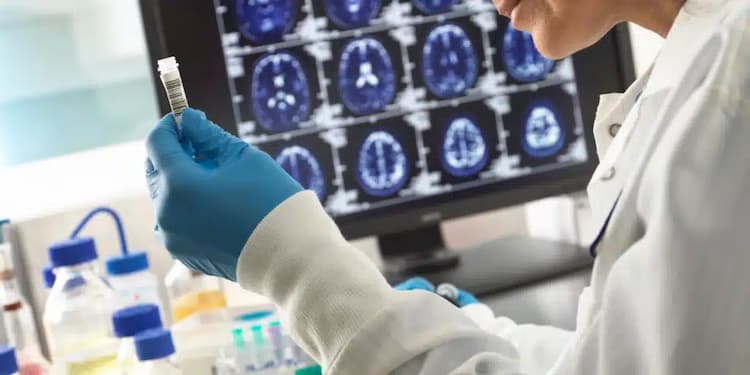 Understanding Alzheimer’s:  An In-Depth Look at Disease Development, Treatment, and Prevention