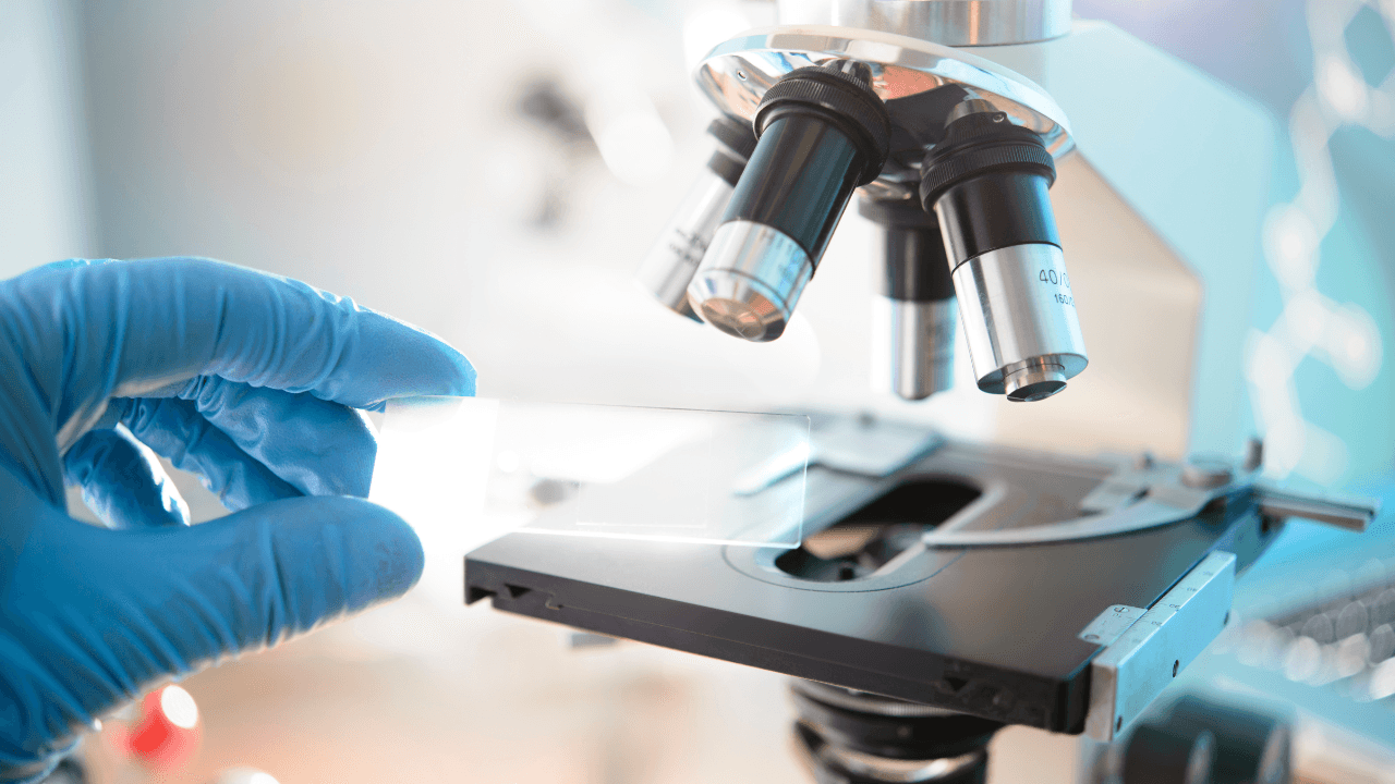 Rethinking the Cause of Alzheimer’s: New Research Redefines Old Theory