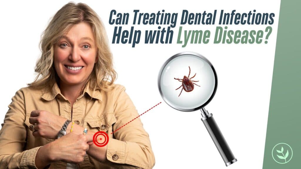 Lyme Disease! Can Treating Dental Infections Help?