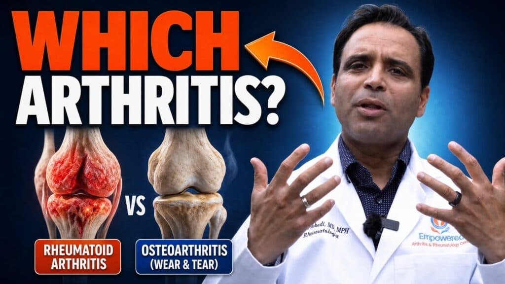 Osteoarthritis vs Rheumatoid Arthritis