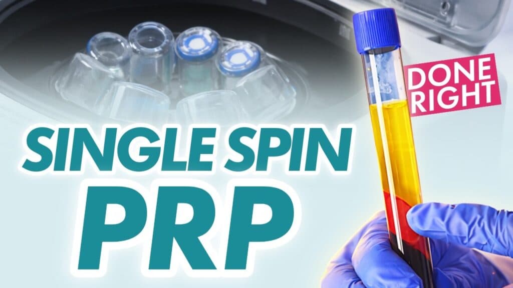 Single Spin PRP Preparation | Step-by-Step
