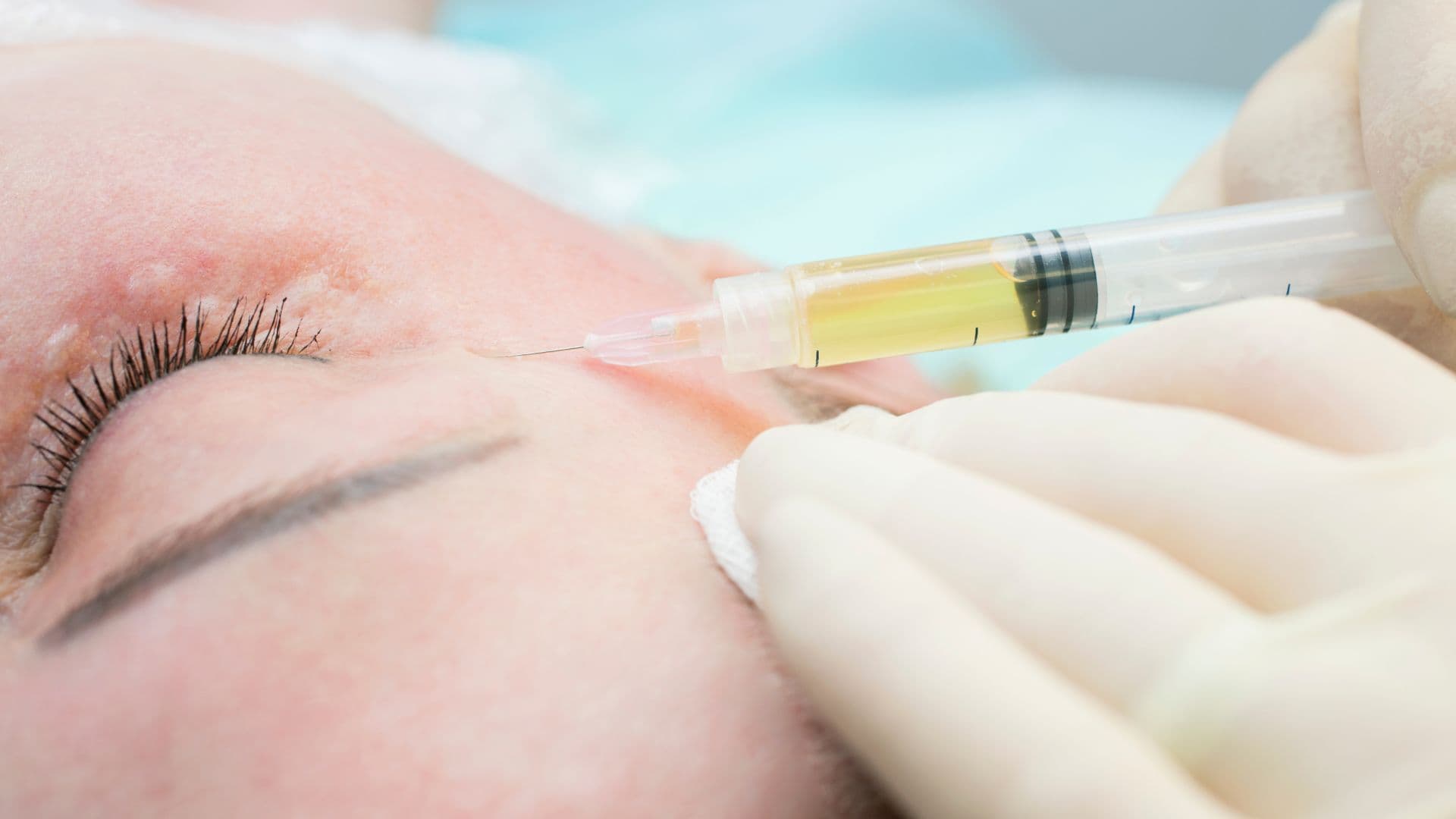 How Are Peptide Injections Promoting Youthful Skin?
