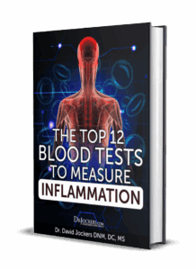 Top 12 Blood Tests To Measure Inflammation