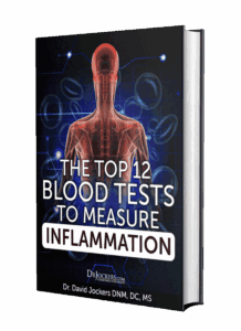 Top 12 Blood Tests To Measure Inflammation