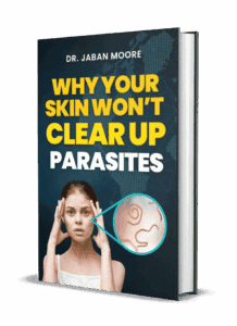 Why Your Skin Won't Clear Up: Parasites