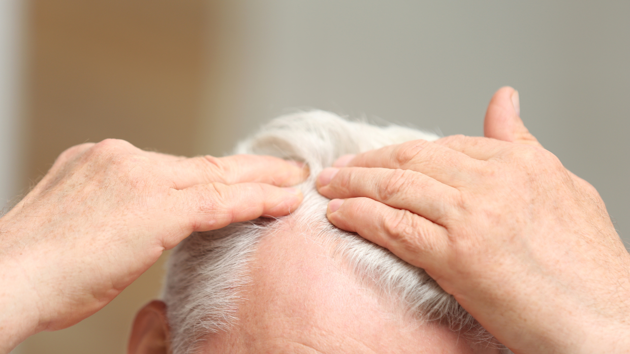 Skin Cancer on the Scalp: Identification and Treatment